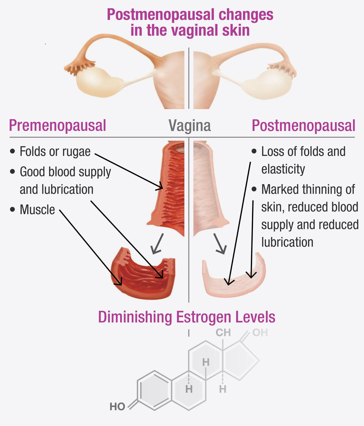 Vaginal Atrophy and Vaginismus – vaginismus.com